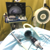 Surgery for Hysteroscopy